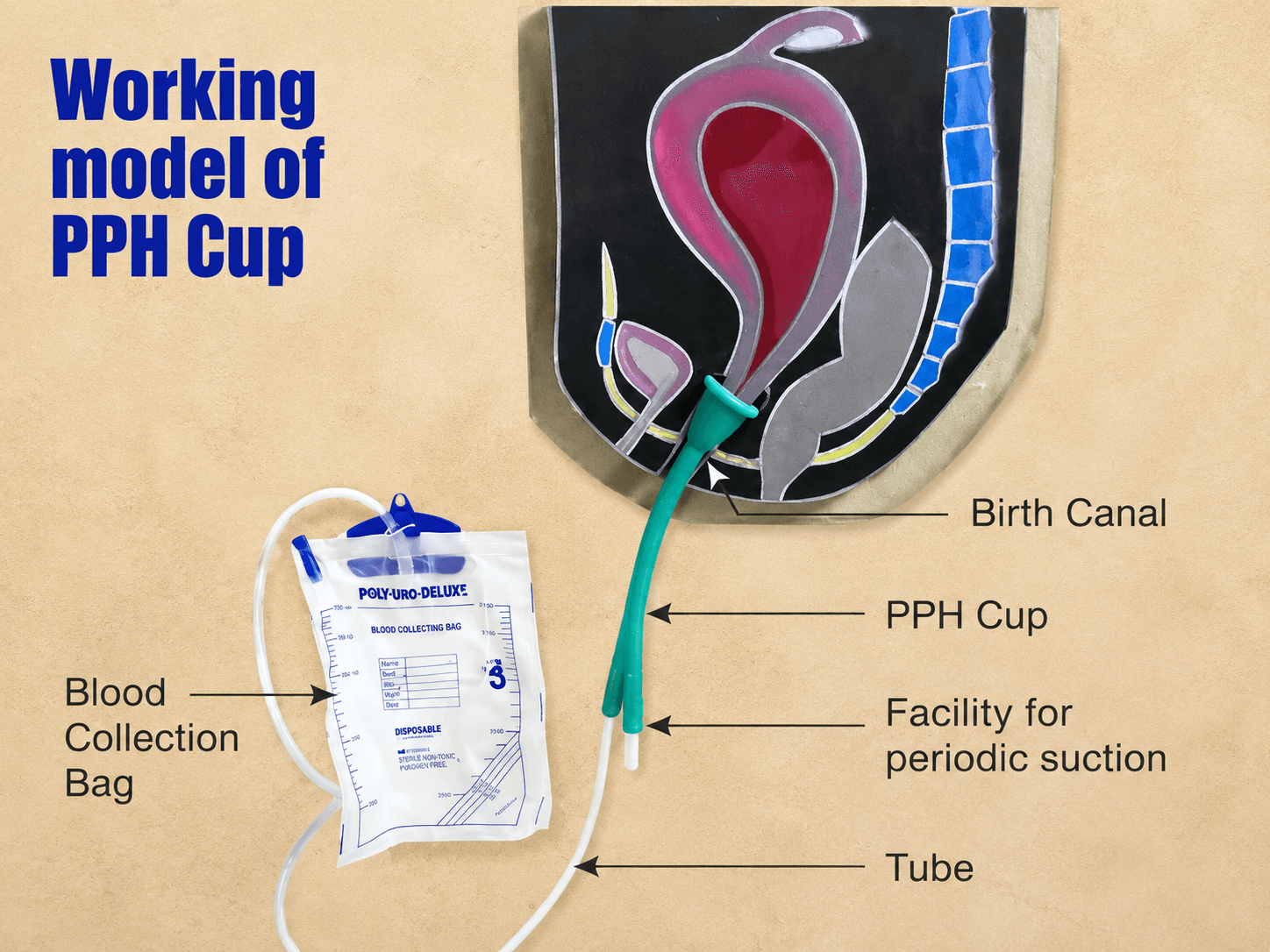 Clinical measurement system concept for the PPH Cup